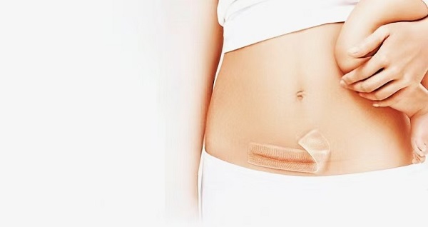 Por que as folhas espessas de gel de silicone para cicatrizes são tão populares?